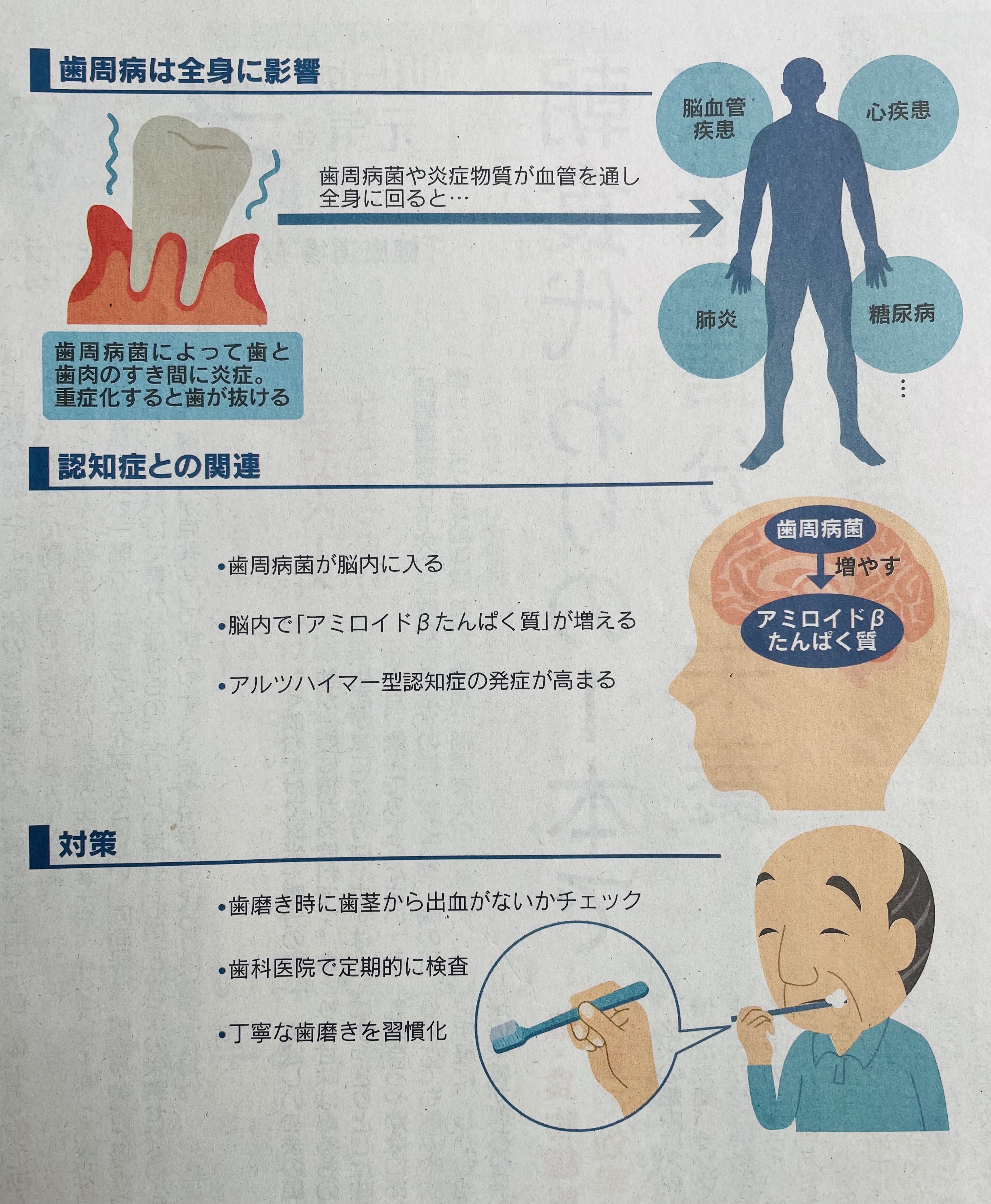 歯周病を科学する ビジュアル 歯周病を科学する - クインテッセンス出版