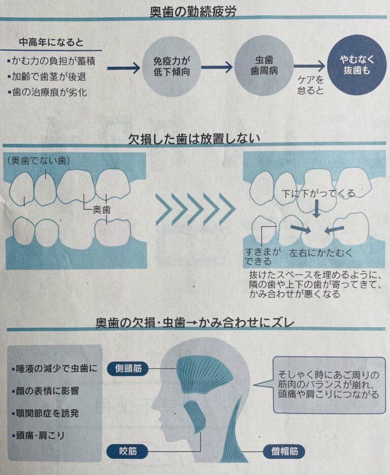 奥歯のダメージを放置すると、頭痛、肩凝りの要因にも！ スタッフブログ 熊本パール総合歯科クリニック