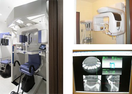 最新鋭の歯科用CT